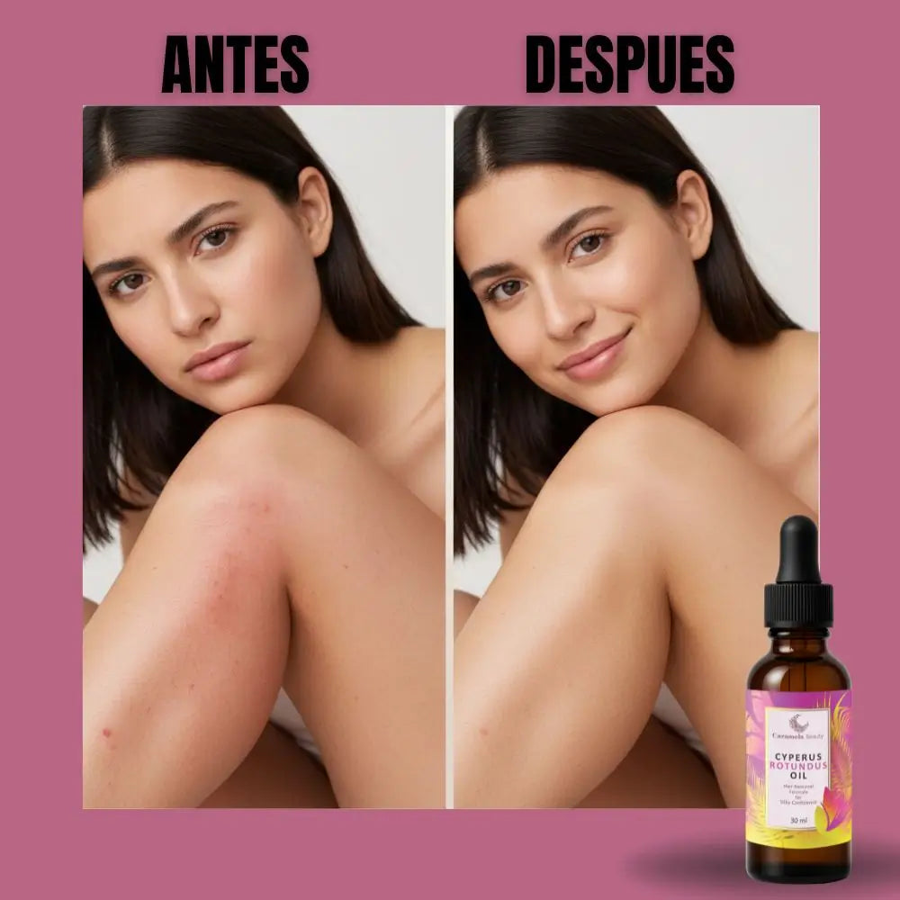 CypeRus Oil - Menos Vello, Más Días de Piel Suave